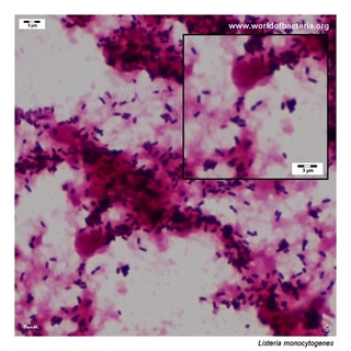 Gram stain microscopy of Listeria monocytogenes showing small gram-positive rods