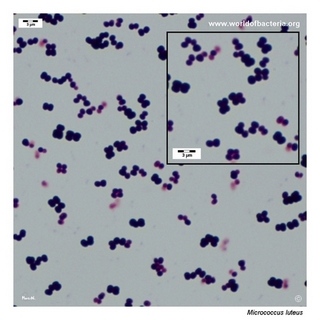 Gram stain microscopy of Micrococcus luteus showing gram-positive cocci in tetrads