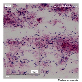 Gram stain microscopy of Mycobacterium smegmatis showing poorly gram-staining acid-fast rods
