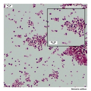 Gram stain microscopy of Neisseria subflava showing gram-negative diplococci
