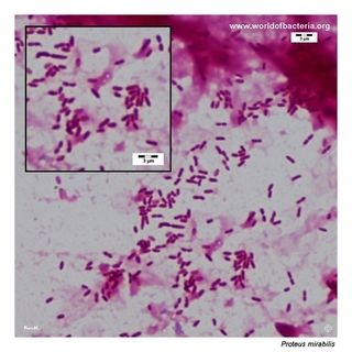 Gram stain microscopy of Proteus mirabilis showing gram-negative rods