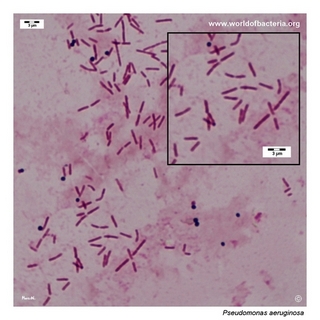 Gram stain microscopy of Pseudomonas aeruginosa showing gram-negative rods