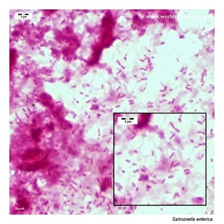 Gram stain microscopy of Salmonella enterica showing gram-negative rods