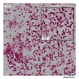 Gram stain microscopy of Shigella flexneri showing gram-negative rods