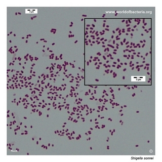 Gram stain microscopy of Shigella sonnei showing gram-negative rods