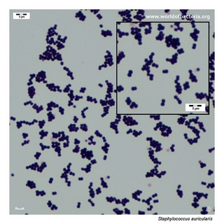Gram stain microscopy of Staphylococcus auricularis showing gram-positive cocci in clusters