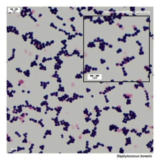 Gram stain microscopy of Staphylococcus borealis showing gram-positive cocci in clusters