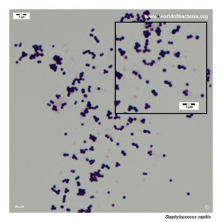 Gram stain microscopy of Staphylococcus capitis showing gram-positive cocci in clusters