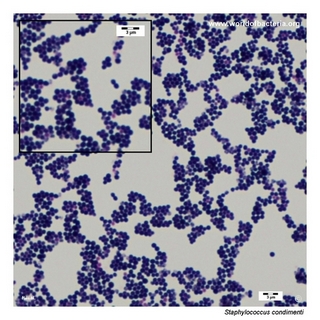 Gram stain microscopy of Staphylococcus condimenti showing gram-positive cocci in clusters