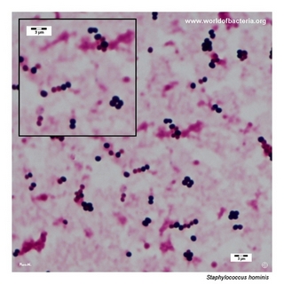 Gram stain microscopy of Staphylococcus hominis showing gram-positive cocci in clusters