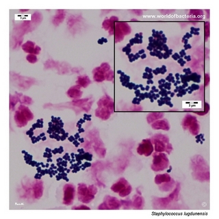 Gram stain microscopy of Staphylococcus lugdunensis showing gram-positive cocci in clusters