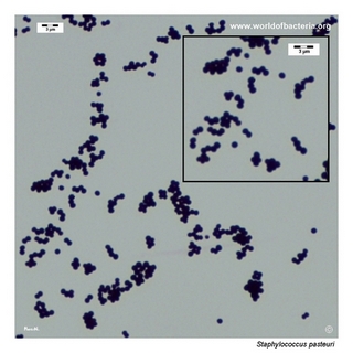 Gram stain microscopy of Staphylococcus pasteuri showing gram-positive cocci in clusters