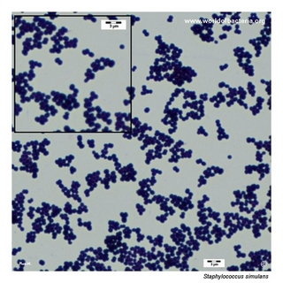 Gram stain microscopy of Staphylococcus simulans showing gram-positive cocci in clusters