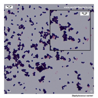 Gram stain microscopy of Staphylococcus warneri showing gram-positive cocci in clusters
