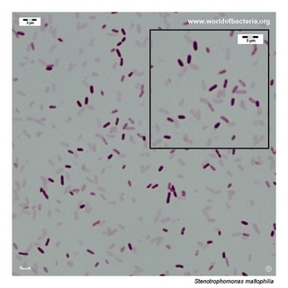 Gram stain microscopy of Stenotrophomonas maltophilia showing gram-negative rods