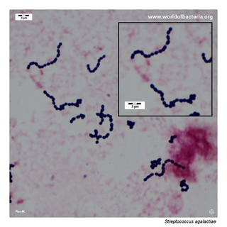 Gram stain microscopy of Streptococcus agalactiae showing gram-positive cocci in chains
