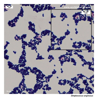 Gram stain microscopy of Streptococcus anginosus showing gram-positive cocci in chains
