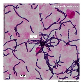 Gram stain microscopy of Streptococcus dysgalactiae showing gram-positive cocci in chains