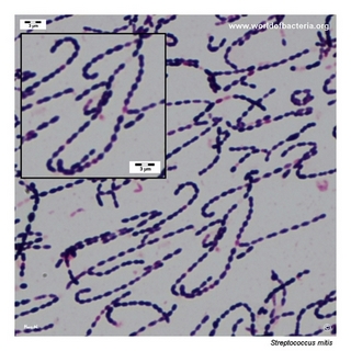 Gram stain microscopy of Streptococcus mitis showing gram-positive cocci in chains