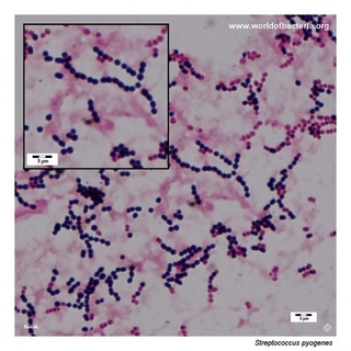Gram stain microscopy of Streptococcus pyogenes showing gram-positive cocci in chains