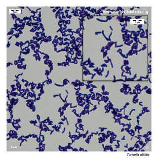 Gram stain microscopy of Turicella otitidis showing gram-positive coryneform rods