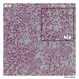 Gram stain microscopy of Vibrio cholerae showing gram-negative curved rods