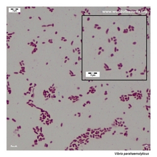 Gram stain microscopy of Vibrio parahaemolyticus showing gram-negative curved rods